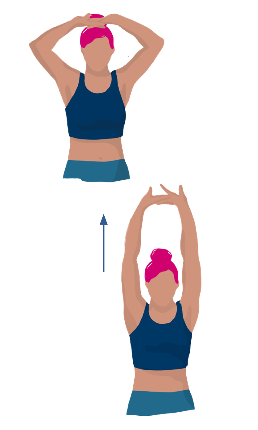 Ejercicio de flexión de hombros de entrenamiento físico tras el alta hospitalaria por evento cardiovascular