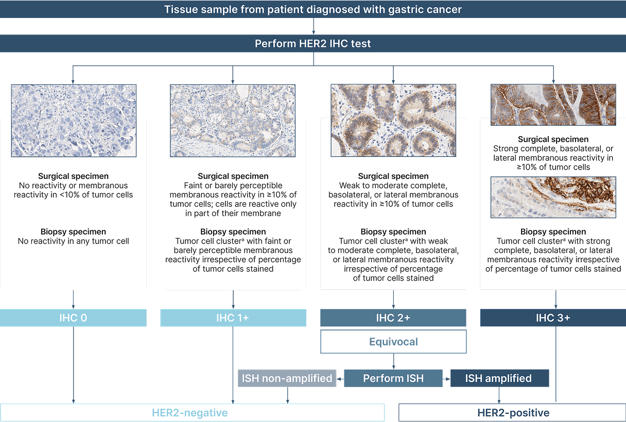 ASCO-CAP Gastric Cancer Scoring Criteria Algorithm Image