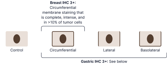 Staining Patterns Required for IHC 3+ Image