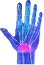 Bilateral Carpal Tunnel Syndrome